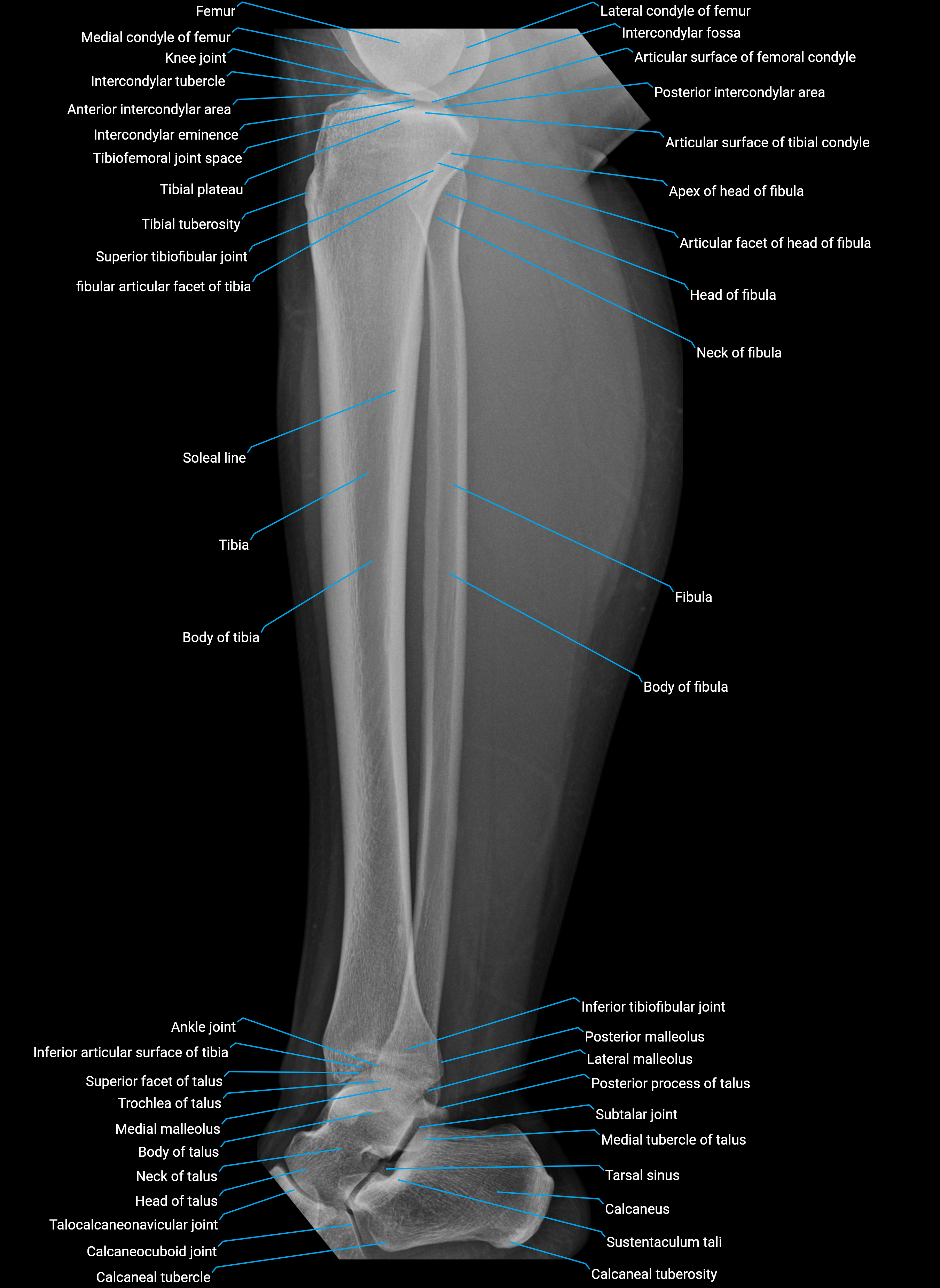x ray  lower leg lat anatomy.png